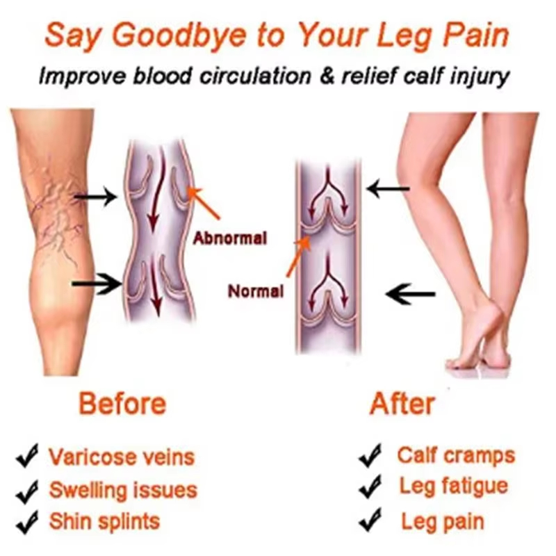 Kadın Sıkıştırma Çorapları Zay - Compression Sleeve Calf incelemesi ve fiyatı